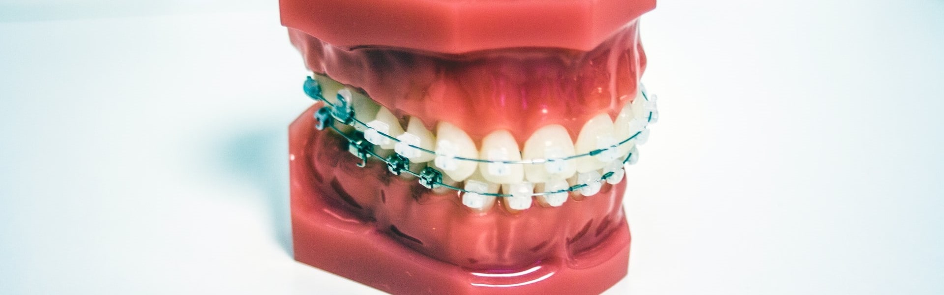 Одномоментная имплантация зубов: красивая улыбка за один день