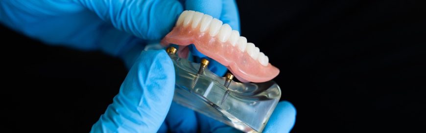 Противопоказания к имплантации зубов, ограничения, диагностика