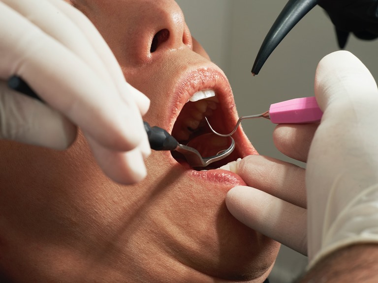 Отличия имплантации от других методов восстановления зубов
