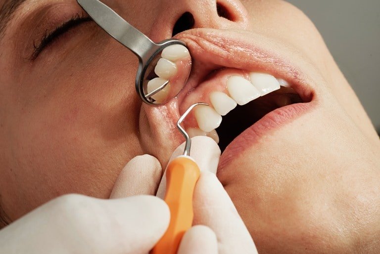 Понятие и показание к имплантации зубов