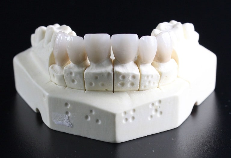 Виды полного протезирования зубов