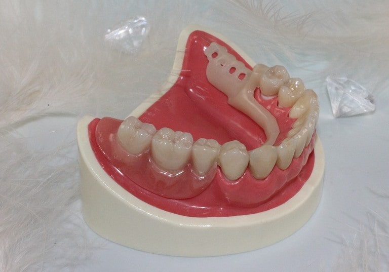 Диагностика перед имплантацией зубов
