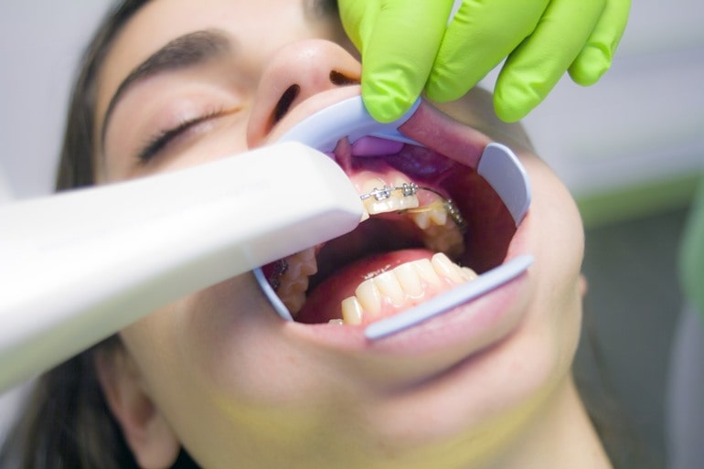 Симптомы и диагностика выпадения зубов у взрослого 
