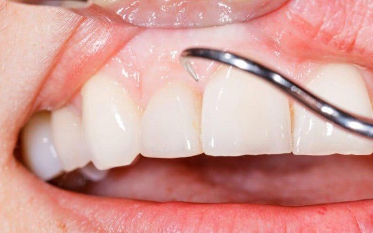 Правила профилактики заболеваний зубов