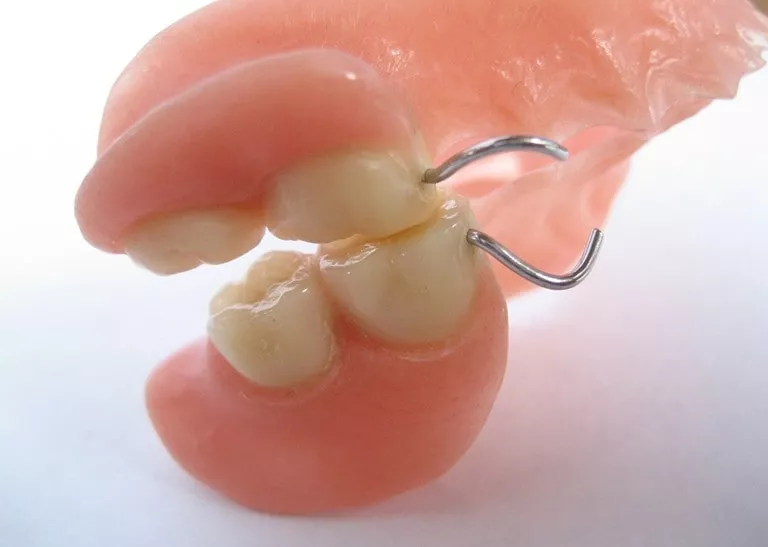 Осложнения после протезирования зубов