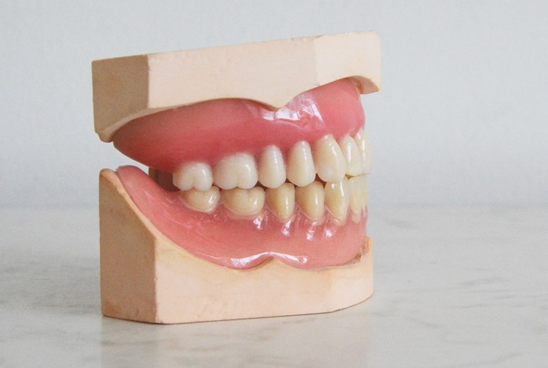 Критерии выбора зубных протезов
