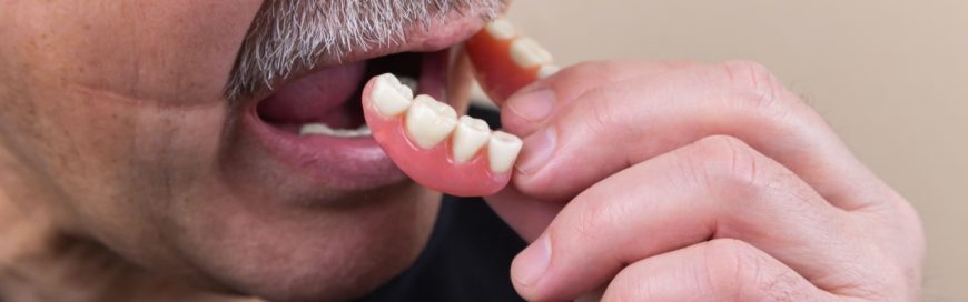 Полное протезирование зубов – виды, материалы, особенности процедуры
