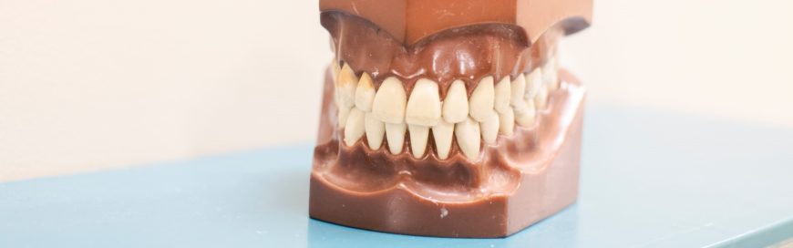Имплантация верхней челюсти: методики и материалы