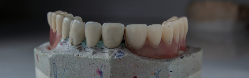 Какие зубные протезы самые лучше: виды и материалы изготовления