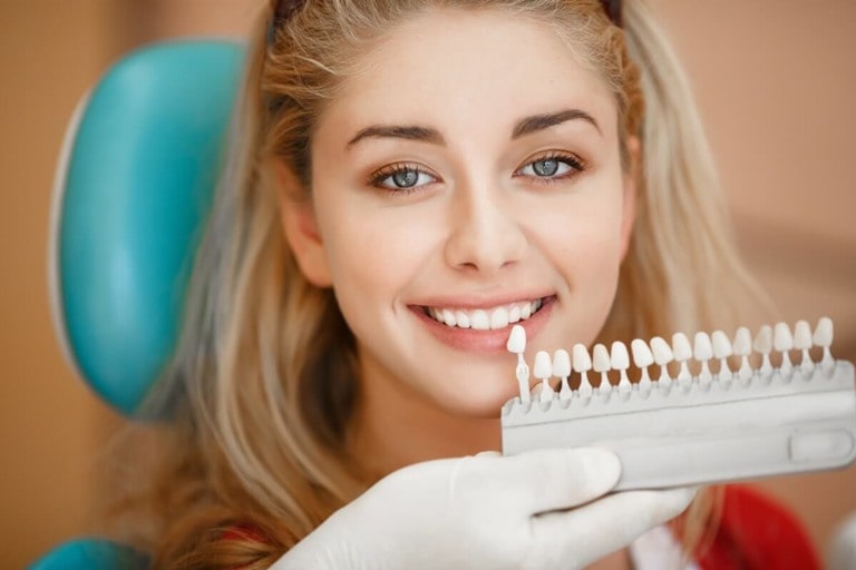 5 мифов о винирах для зубов
