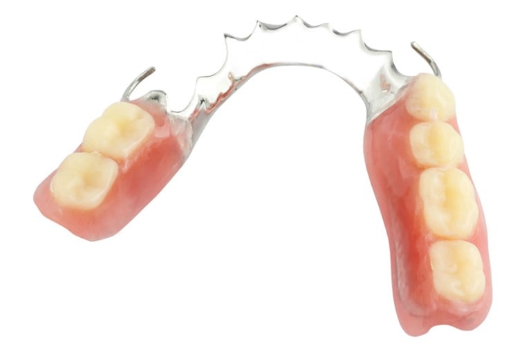 6 видов частичных съемных зубных протезов