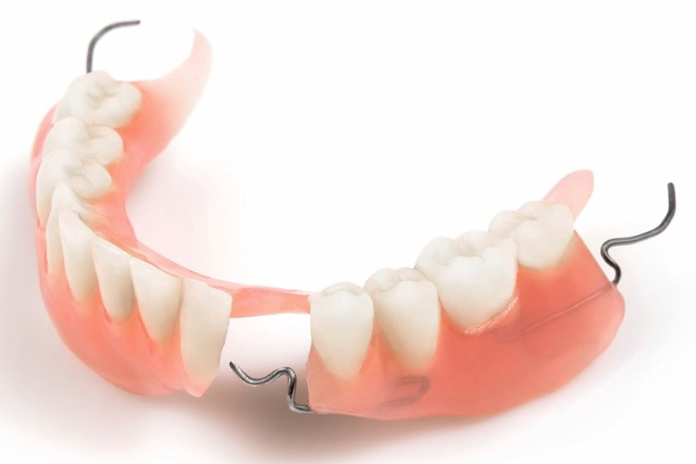 Особенности фиксации частичных зубных протезов