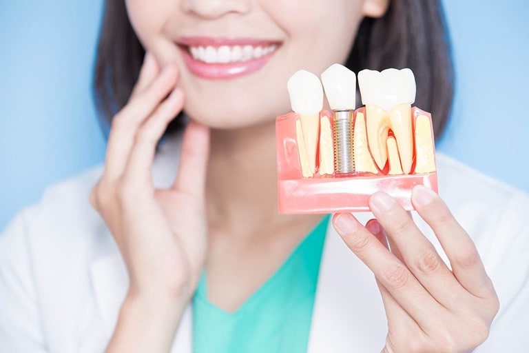 Имплантация, когда плохие зубы уже не поддаются лечению