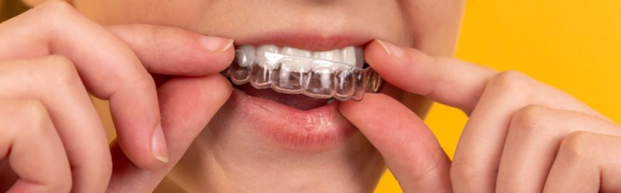 Зубы без эмали: причины и лечение