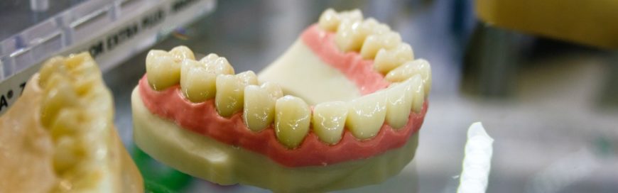 Как крепятся протезы, если нет зубов: основные способы и их особенности