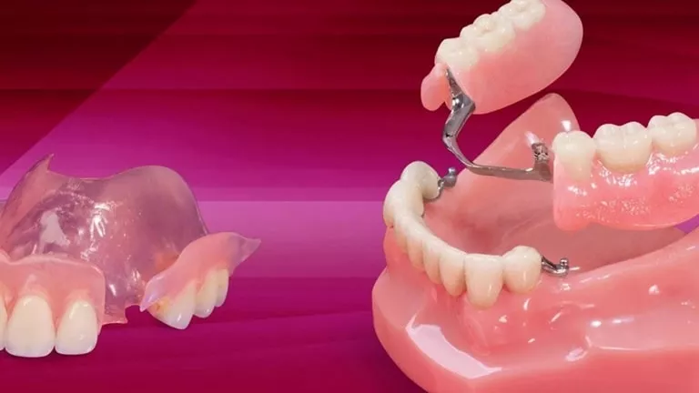 Особенности протезирования жевательных зубов