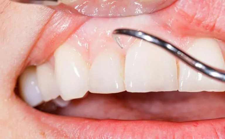 Виды смещения зубов