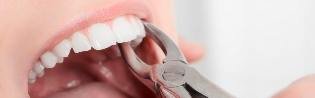 Чем полоскать рот после удаления зуба, чтобы снять боль и воспаление