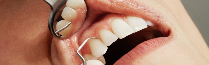 Кюретаж в стоматологии: что это и как проводится