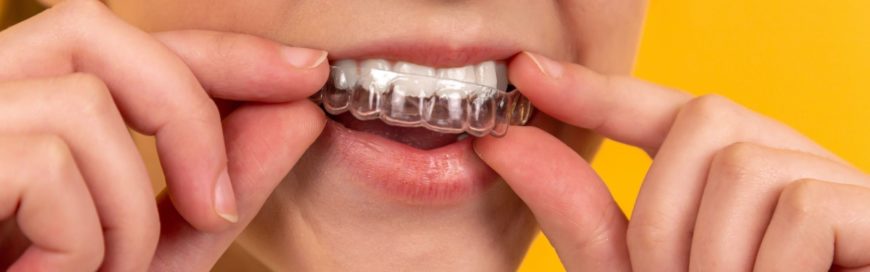 Почему зубы желтые: как решить эту проблему