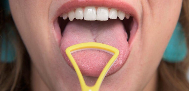 Рекомендации по уходу за полостью рта