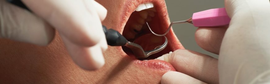 Болит зуб после лечения кариеса: причины, диагностика, лечение