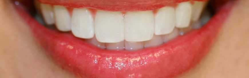 Правильный прикус зубов: как его добиться?