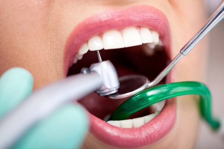 Если долго болит зуб после лечения кариеса из-за начавшегося воспаления
