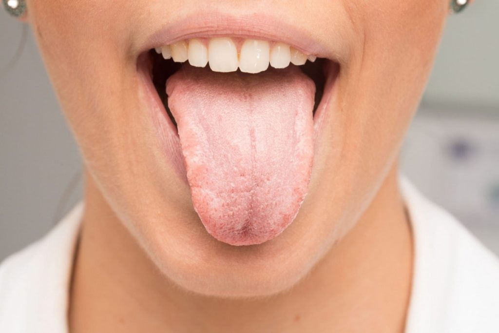 Причины возникновения заболеваний зубов и слизистой полости рта