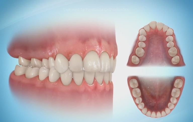 Расположение зубов у взрослого человека