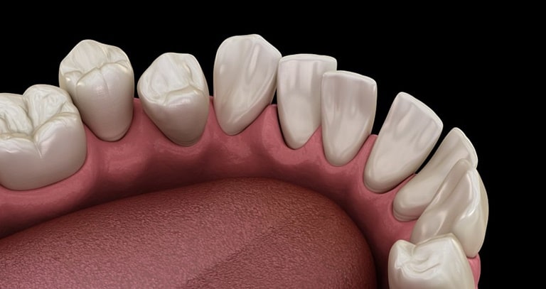 Нормальное и патологическое смещение зубов