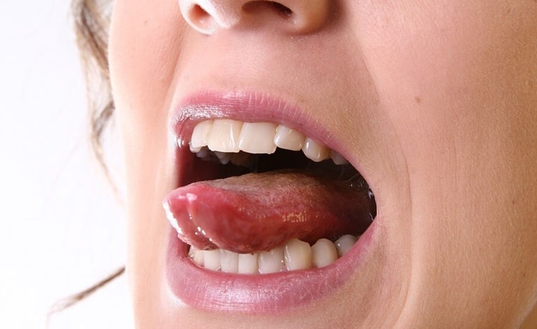 Причины болей под языком