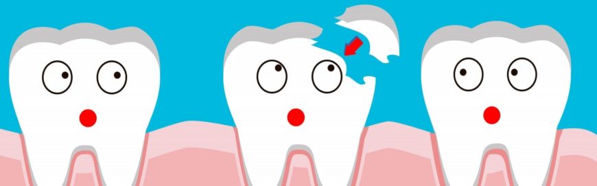 Болит зуб под временной пломбой: причины проблемы и способы ее решения