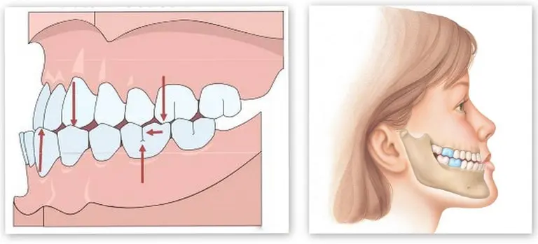 Лечение перелома челюсти в «Dekamedical»