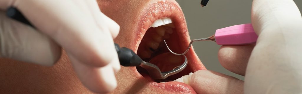 Болит челюсть после удаления зуба: причины и способы лечения