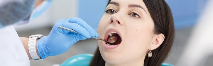 Как вылечить зубы: этапы и методы