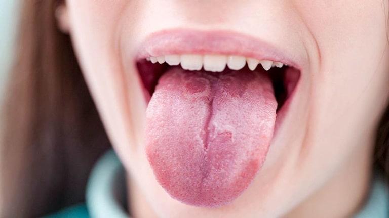 10 причин возникновения боли у основания языка