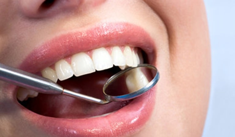 Основные этапы лечения зубов
