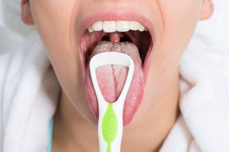 Грибок полости рта: симптоматика и методы лечения