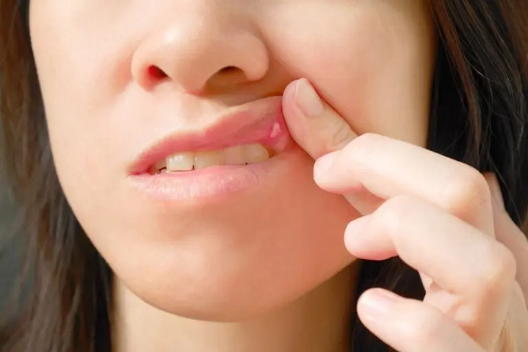 Основные симптомы инфекции полости рта