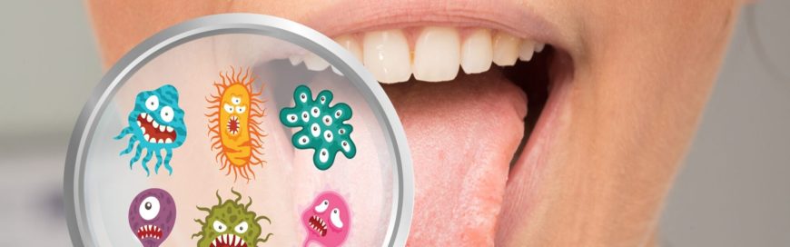 Кандидоз полости рта: почему возникает и как лечить