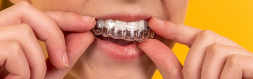 Прозрачные зубы: эстетический недостаток или патология