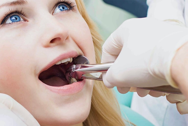 Специфика и последствия удаления зуба