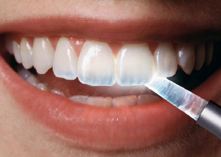 Почему зубы становятся прозрачные 