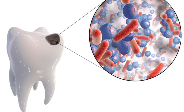 Распространенные бактерии в полости рта