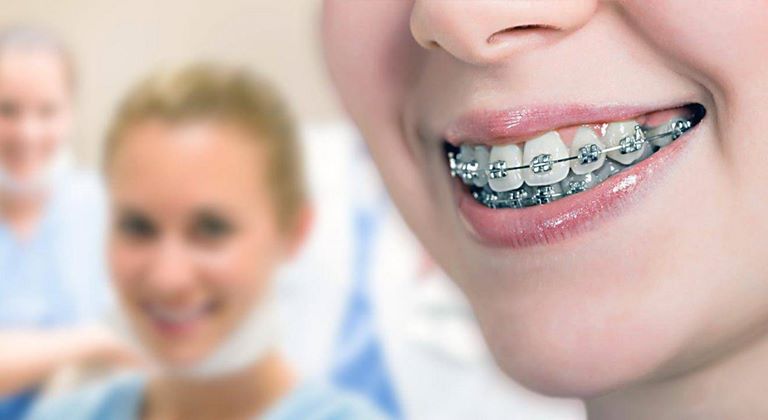 Основные методы ортодонтического лечения