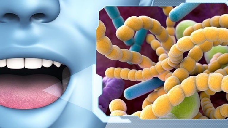 Стадии развития дисбаланса бактерий в полости рта
