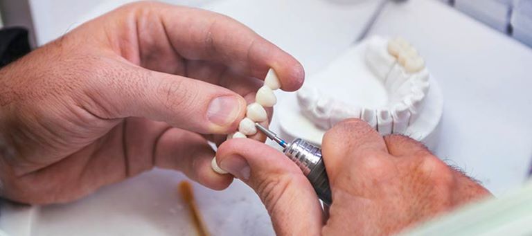 Этапы восстановления зубов частичными протезами