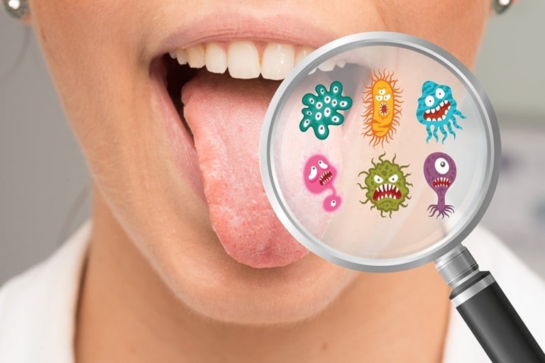 Методы лечения дисбаланса бактерий в полости рта
