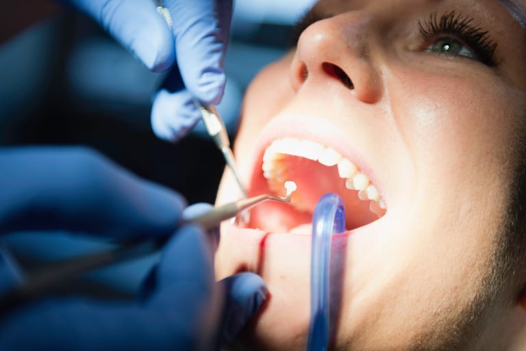 Санация полости рта перед стоматологическими вмешательствами